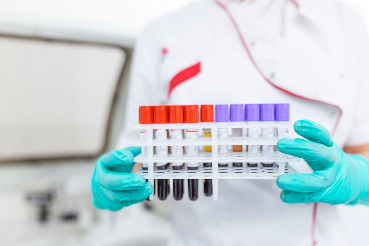 Descubra quais exames confirmam a menopausa incluindo FSH LH e estradiol
