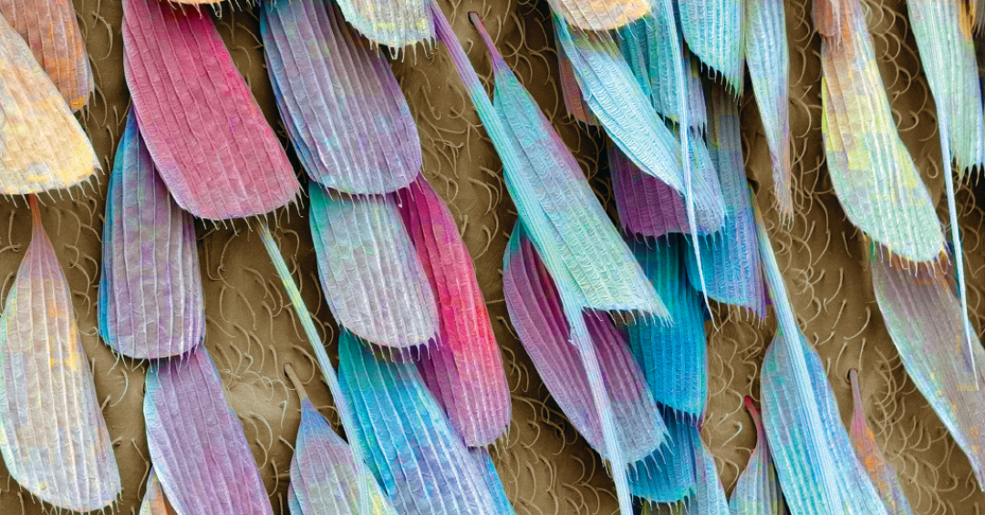 Microescamas de mosquito: inseto é um dos principais vetores de doenças (Foto: GI/Getty Images)