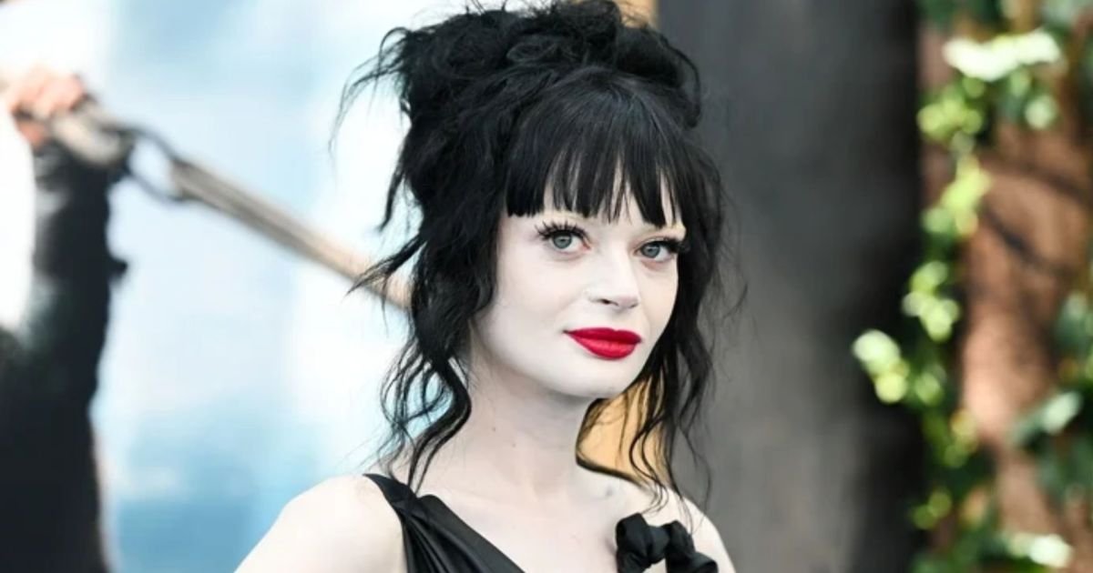 Atriz de Como Treinar o Seu Dragão amputa perna pela 2ª vez  • Instagram / Ruth Codd